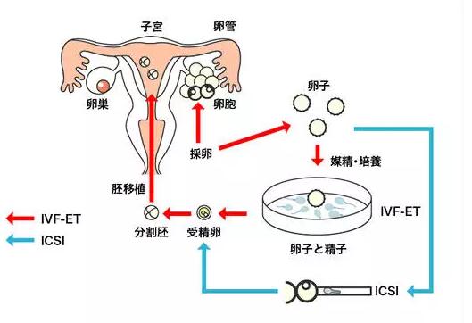 第供卵试管自怀整理9-11+第三代代生双胞胎+取卵移植